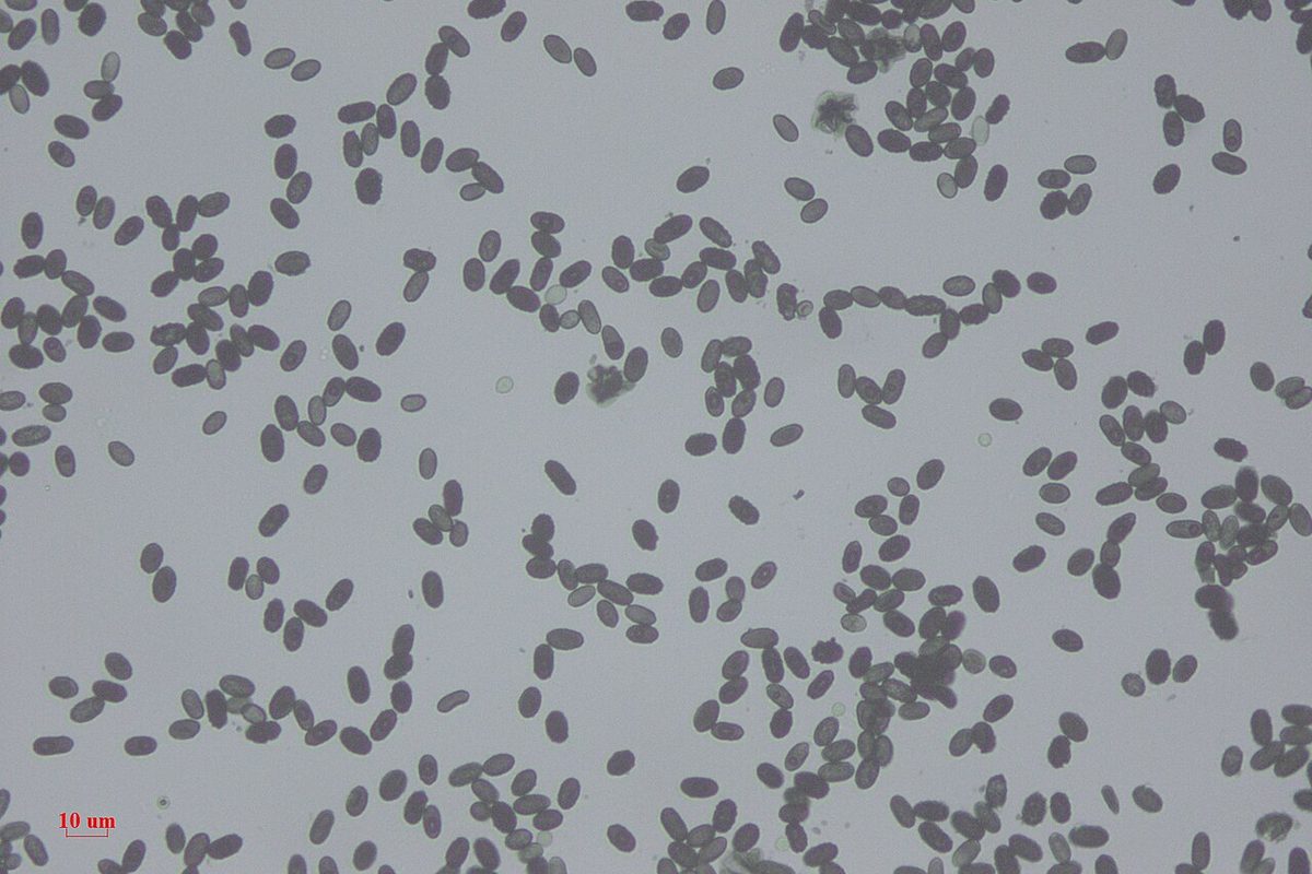 Stachybotrys mold spores under a microscope, the kind of growth that colonizes wet hidden cavities