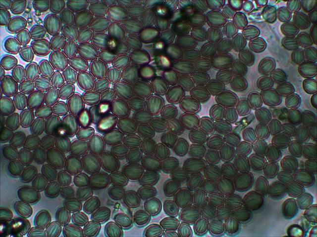 Mold spores magnified under a laboratory microscope during analysis of an air sample